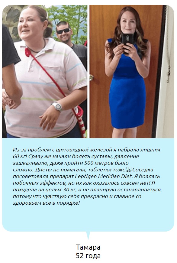 Результат Тамары, 52 года